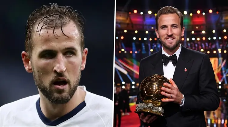 2026 Ballon d'Or Winner Harry Kane Get a Hair Transplant? (Techniques and Details)