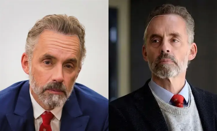 Jordan Peterson Saç Ekimi: Öncesi ve Sonrası