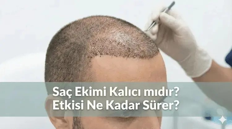 Saç Ekimi Tedavisi Ne Kadar Sürer?
