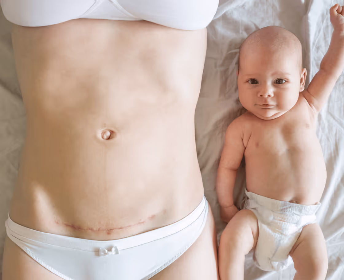 Anne Estetiği Nedir?