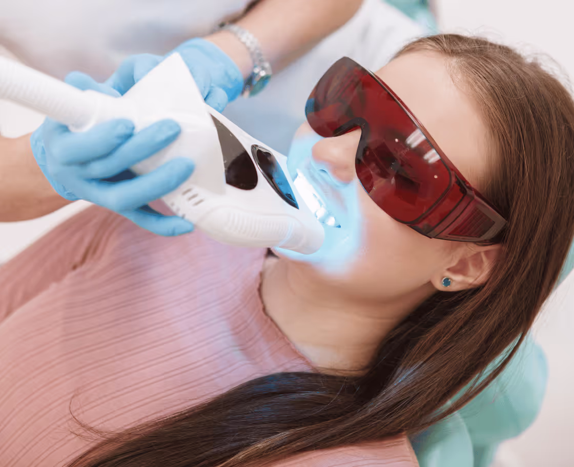 Diş Beyazlatma Nasıl Çalışır?