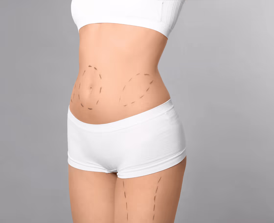 Erwartete Ergebnisse und Vorteile von Mommy Makeover