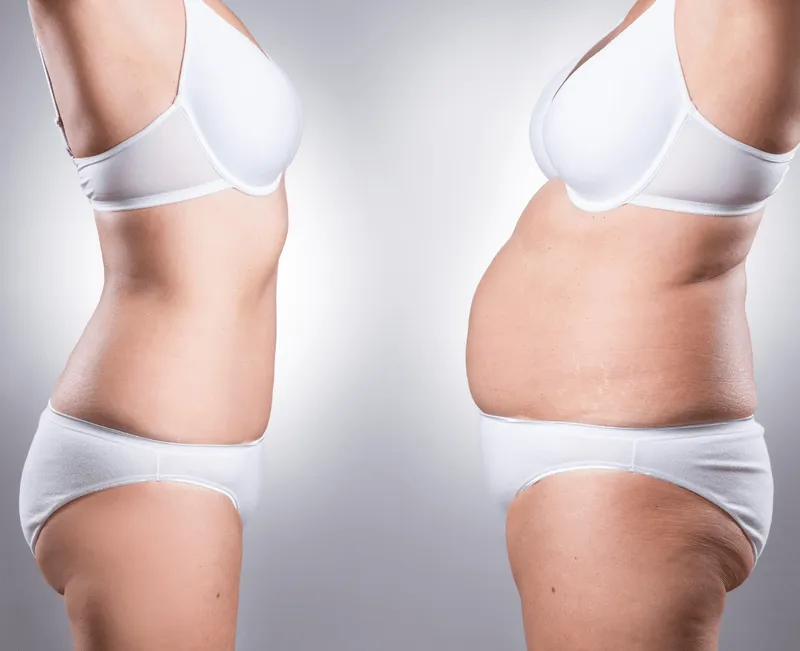 Expected results and benefits of breast lift surgery