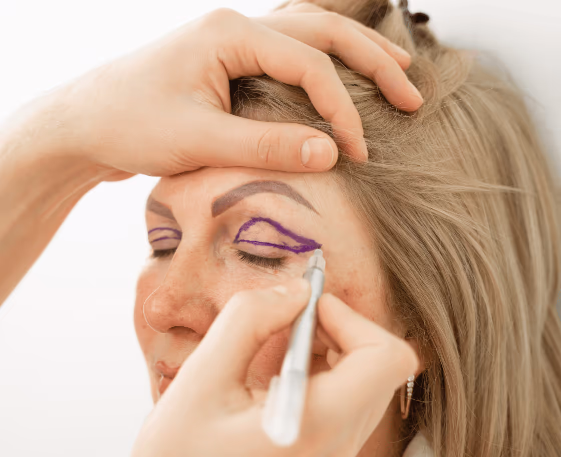 How does Eyelid (Blepharoplasty) surgery work?