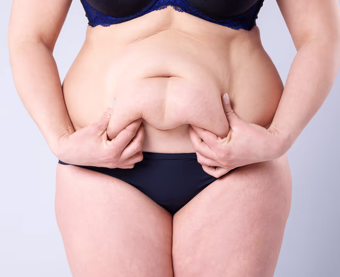 How Does Tummy Tuck Surgery Work?