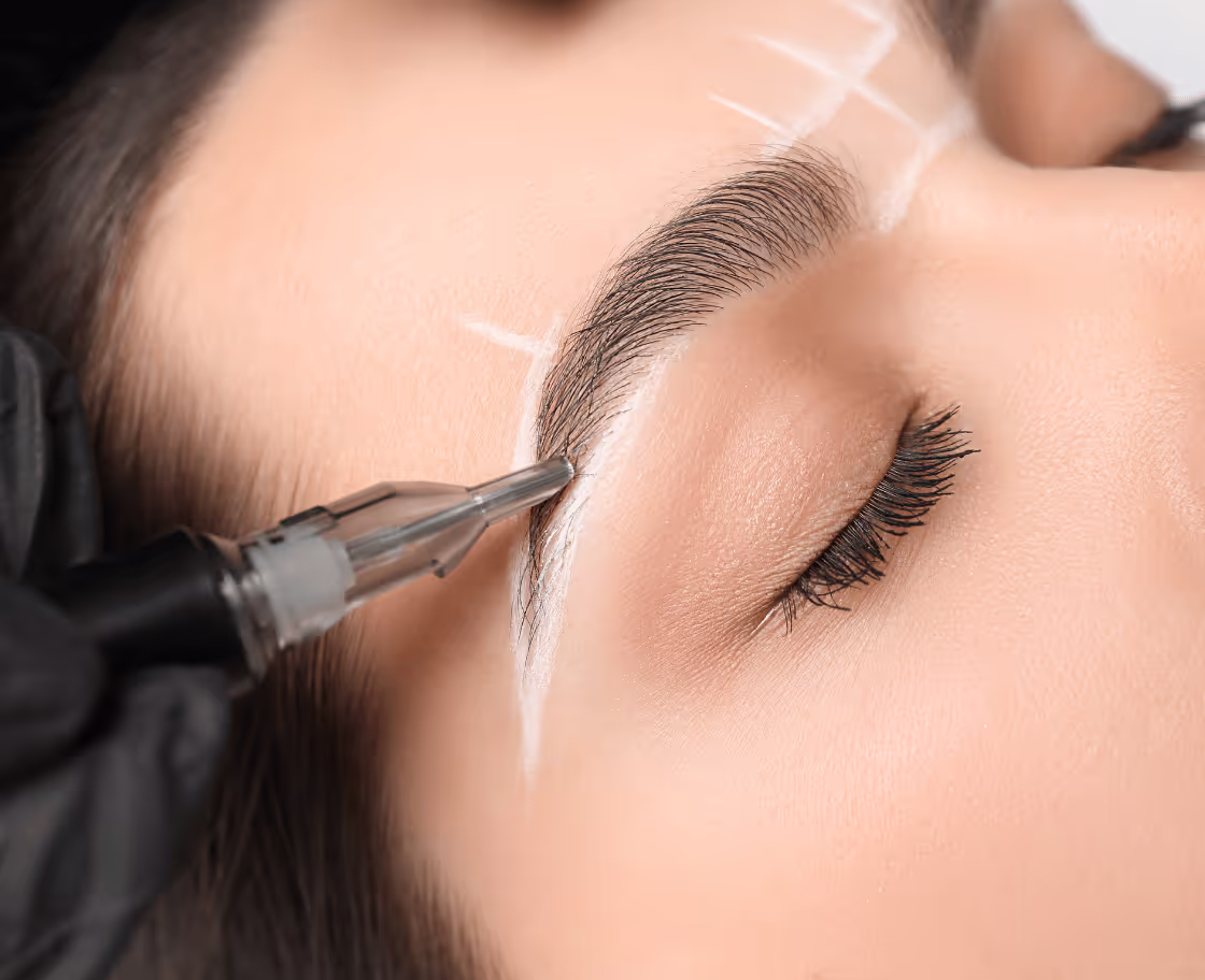 Qu'est-ce que la greffe de sourcils ?