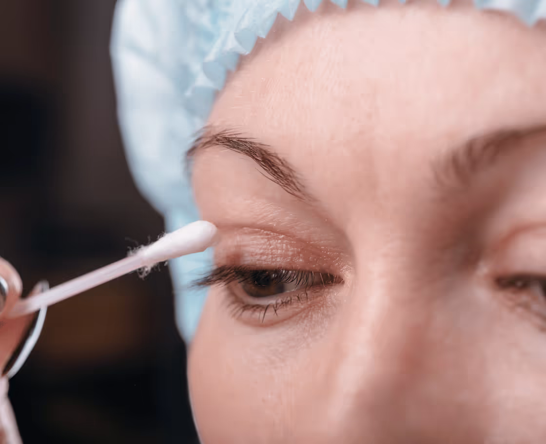 Was ist eine Augenlidoperation (Blepharoplastik)?
