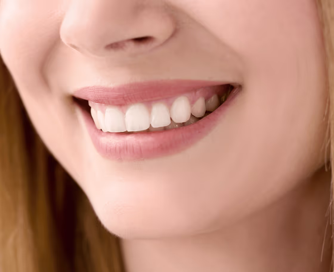 What Is Hollywood Smile Treatment?