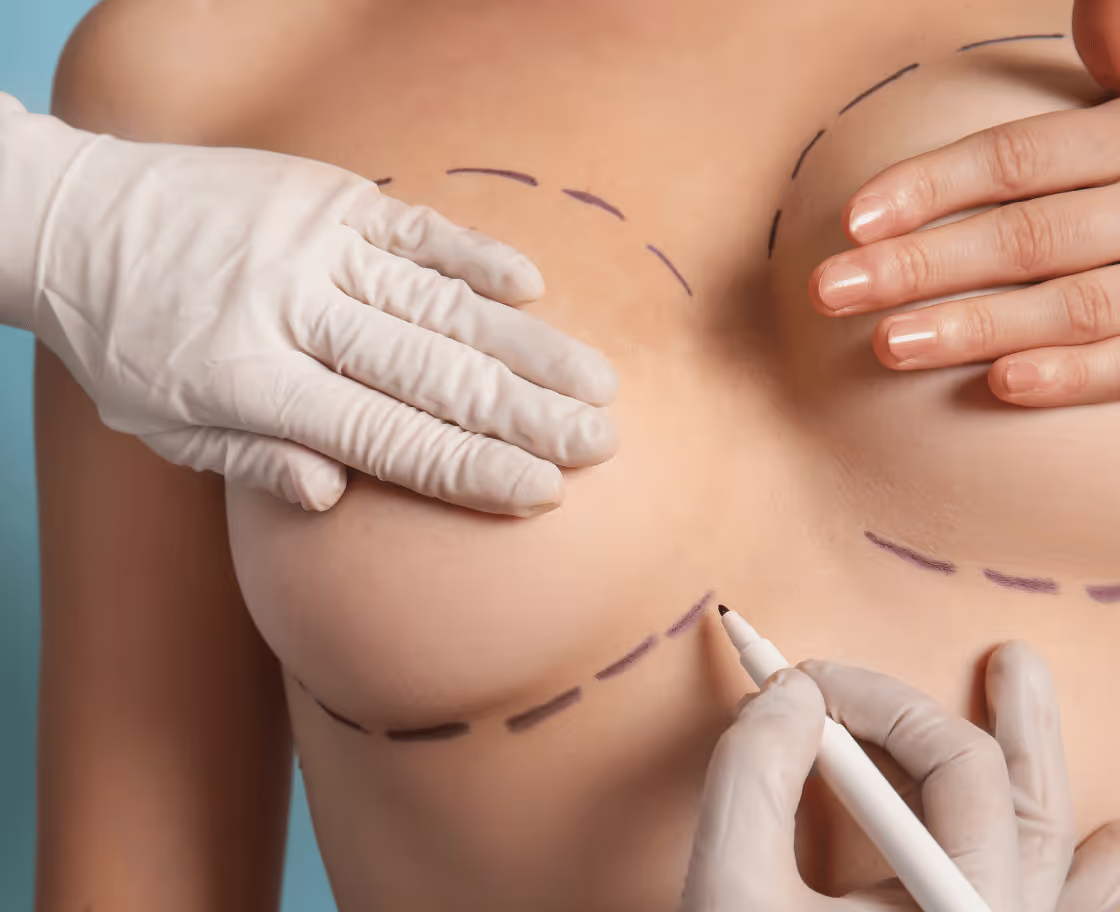 Who Can Benefit from Breast Augmentation Surgery?