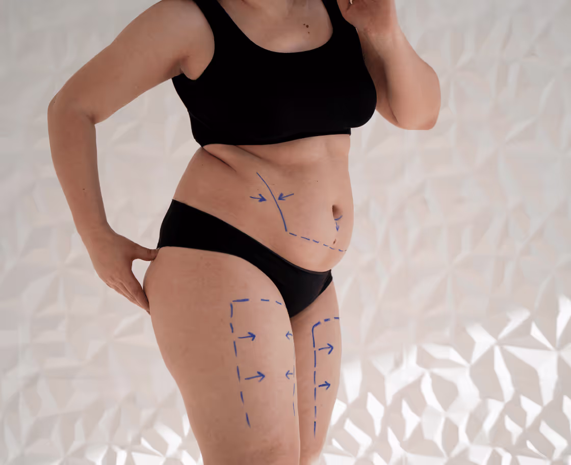 Wie funktioniert das Mommy Makeover?