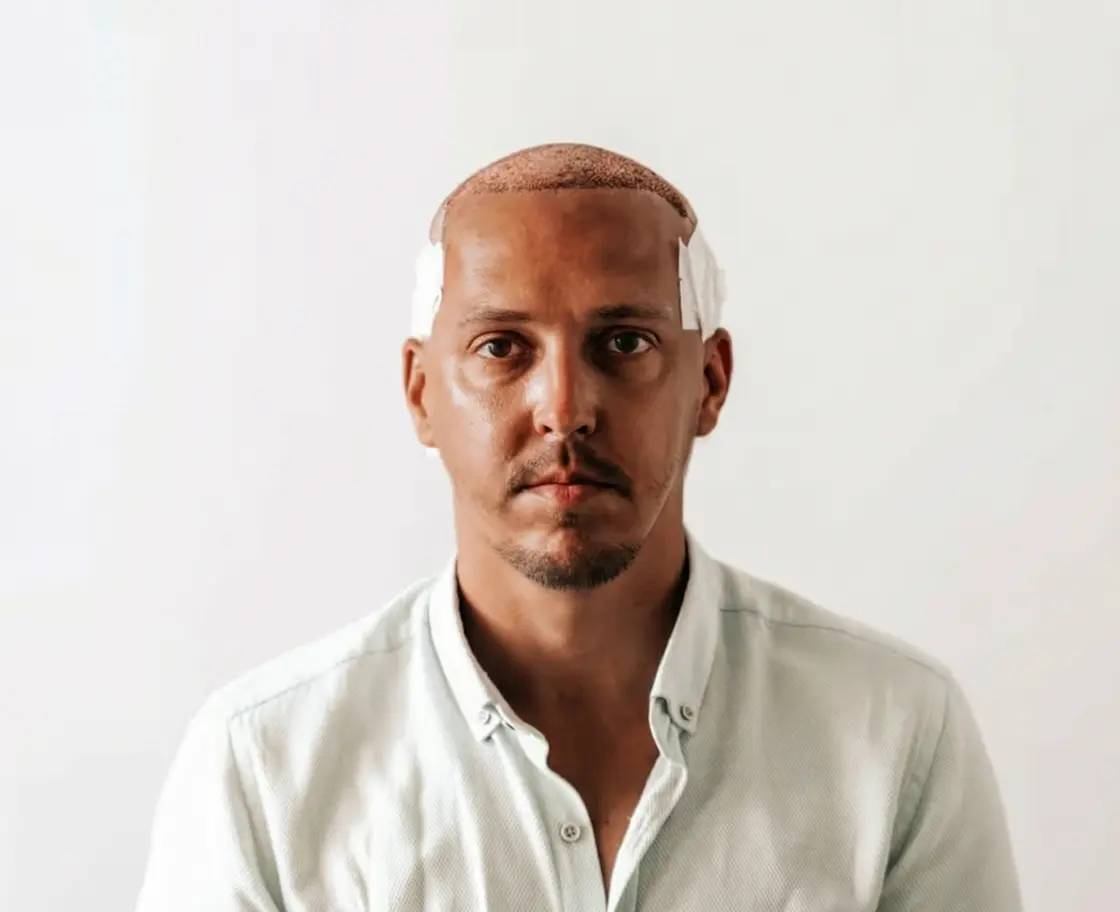 Who Is a Suitable Candidate?