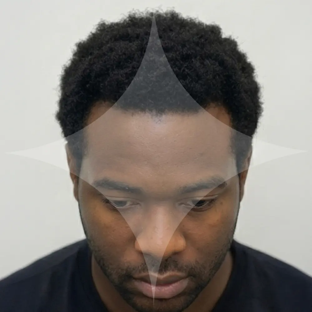 Henry (France 🇫🇷)