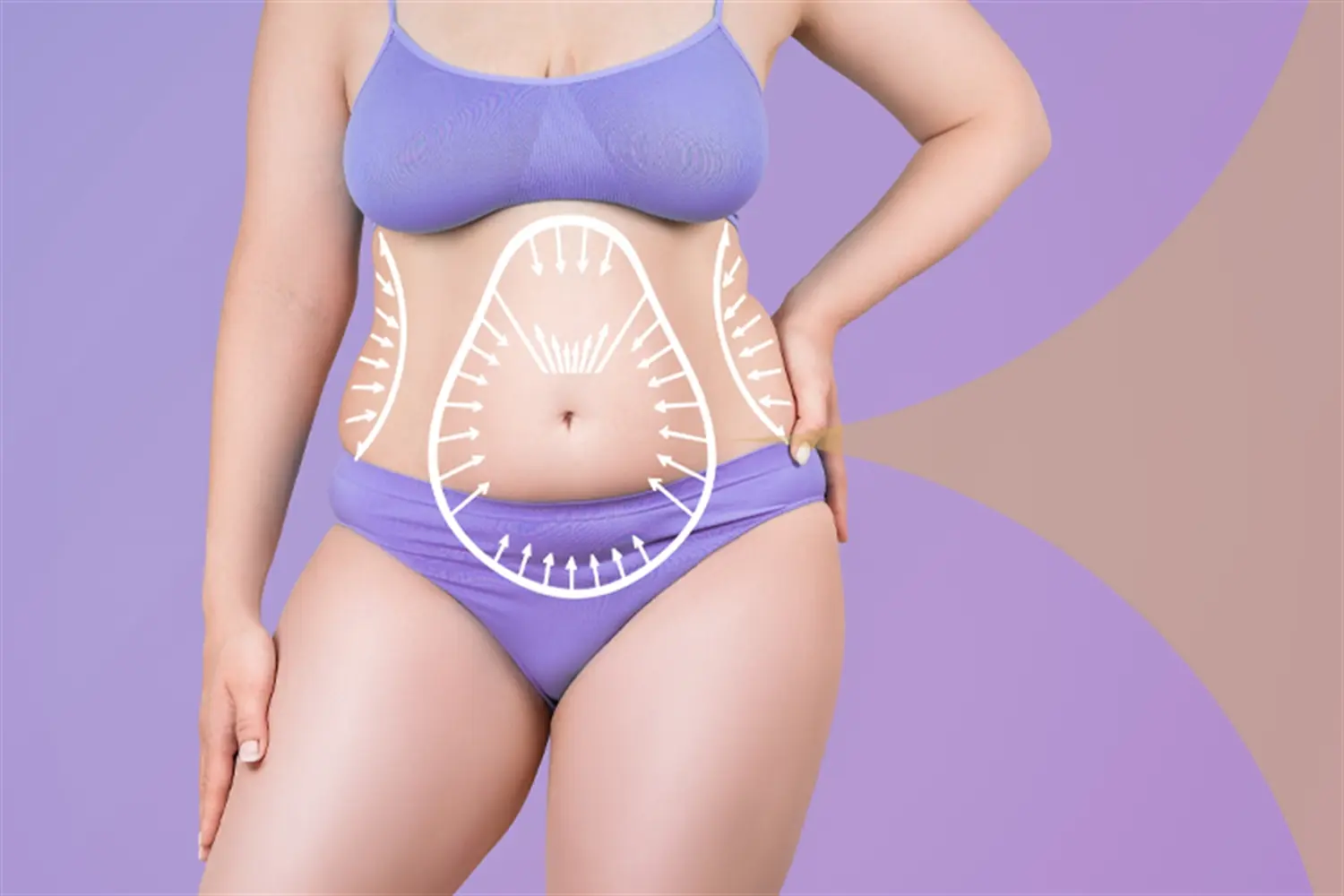 Karın Germe (Abdominoplasti) Ameliyatı