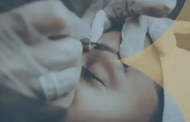 Eyebrow Transplant in Turkey