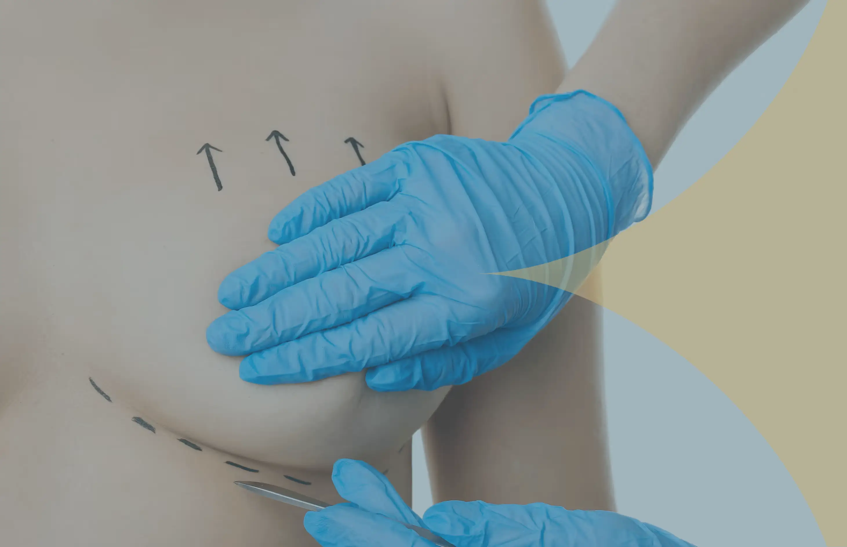 Breast Lift in Turkey