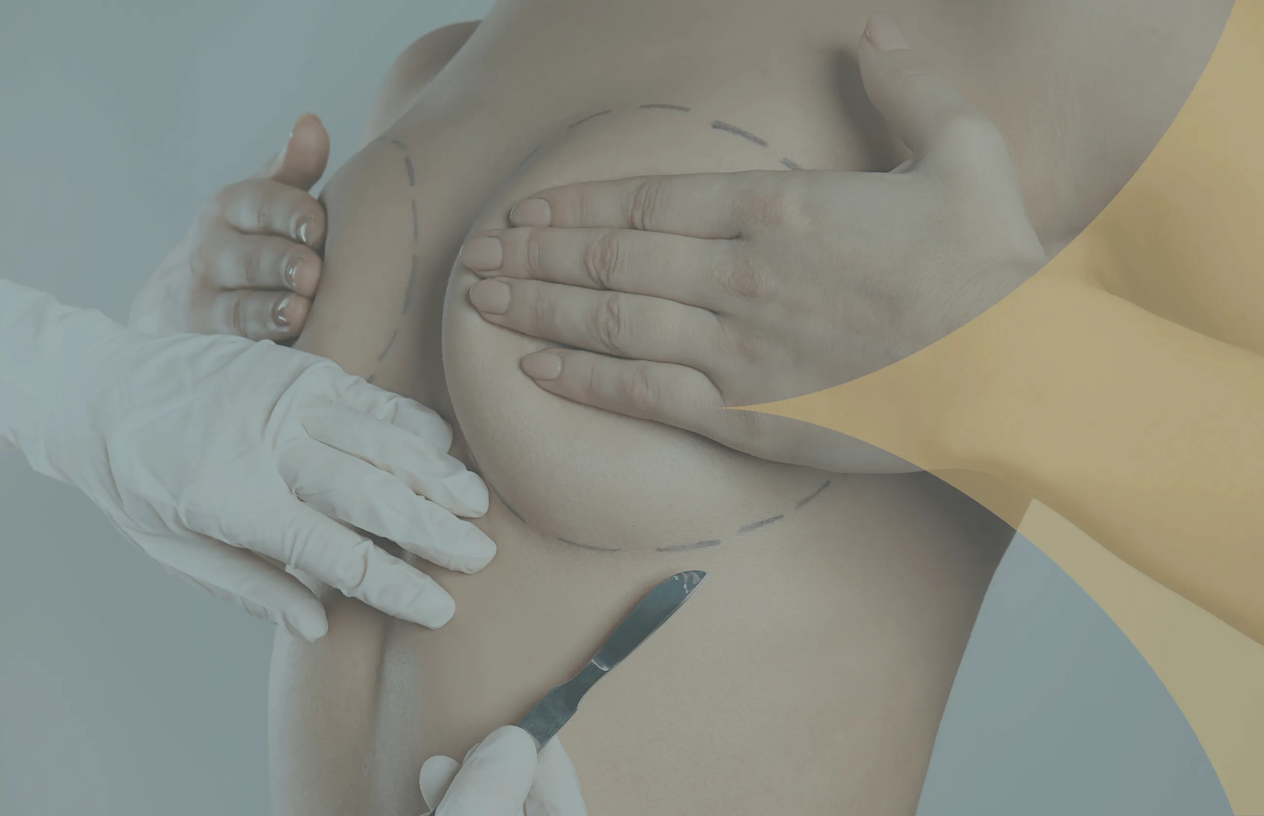 Breast Reduction in Turkey