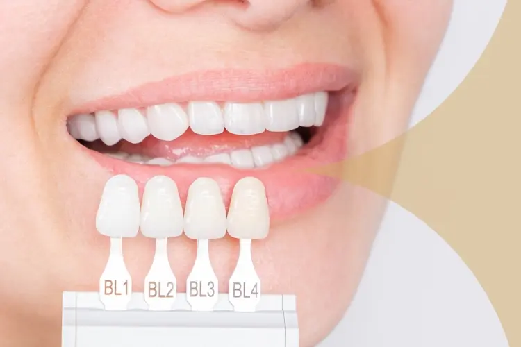 Zirconium Tooth Veneers in Turkey