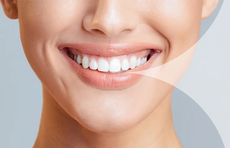 Dental Aesthetics